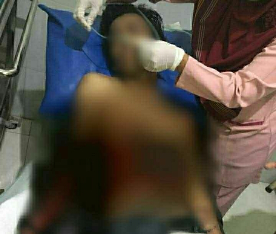 Bom Meledak di Pos PAM di Kartasura, Seorang Terluka