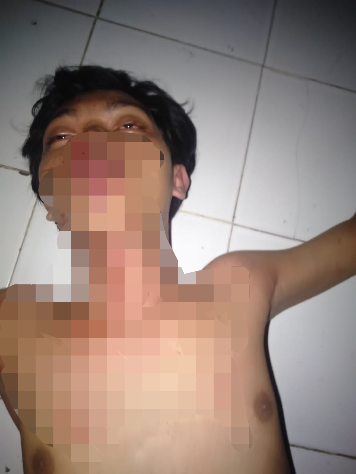 Dikeroyok Sekelompok Pemuda, Alif KF jadi Bulan-bulanan Hingga tak Sadarkan Diri