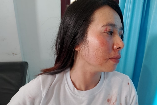 Karena Cemburu Wartawan Dikeroyok Istri Oknum Polisi