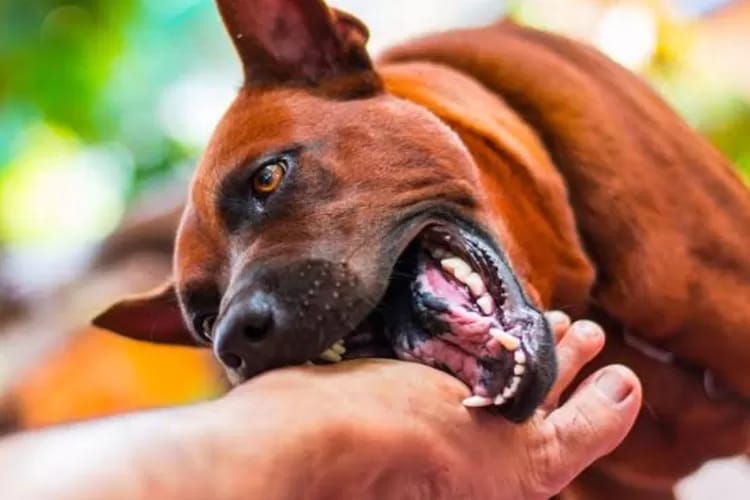Digigit Anjing Rabies, Bocah 4 Tahun Alami Luka Serius