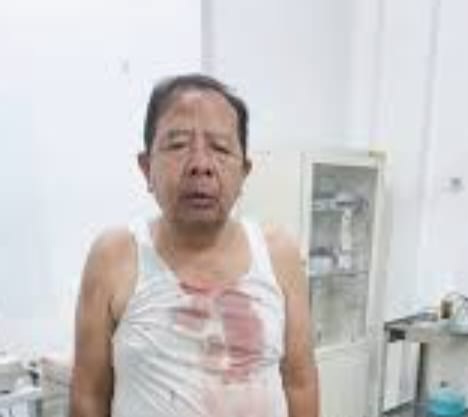 Kapolda Sumut Diminta Tangkap Semua Pelaku Pengeroyokan Pendeta di Sergai